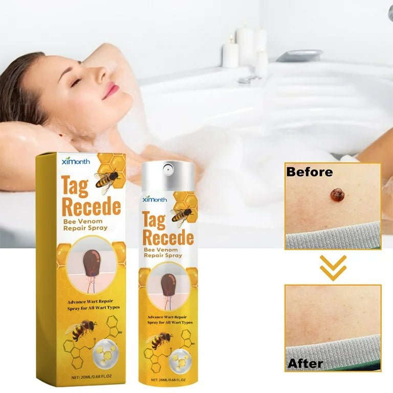 Eliminador de verrugas con veneno de abejas Tag Recede™ - Producto Original - GoMart!